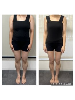 ソニコ 方南町本店(SONICO)/太ももに隙間ができちゃいます