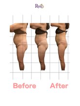 アールユー ギンザ(Ryou ginza)/セルゼロ45分