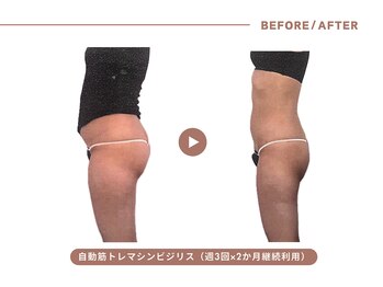 イエス マイサロン(yes My Salon)/自動筋トレマシンBIJIRIS施術例