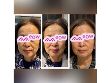 ココスタイルビューティー(COCOSTYLE beauty)の雰囲気（最近リフティング★たるみ，ゆるみ，シワ感想の気になる方へ）