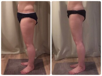 クランシュプール 恵比寿店/【むくみ/脚/冷え】