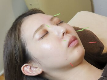 七彩鍼灸院/【鍼灸/美容鍼/恵比寿/代官山】