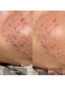 グレイス(Grace)/