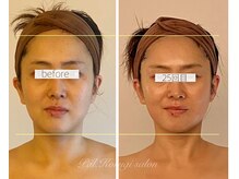 パル コルギサロン(Pal. Korugi salon)/コルギビフォーアフター