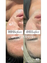 スパアルデバラン(spa.ALDEBARAN)/【もっと早く知りたかった】