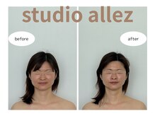 スタジオ アレ(studio allez)の雰囲気（フェイシャルビフォーアフター 1回で頬骨がスッキリ小顔に）