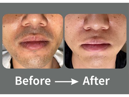 パーミル 千里丘店(per mille‰)の写真