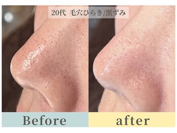 ムク(Muqu.)/毛穴ケア迷子になってませんか？