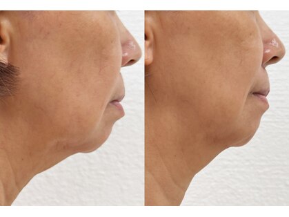 ワミング(Wa mingu)の写真