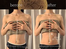 リムーン(REMOON.)/施術後の効果★