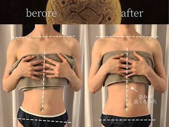 リムーン(REMOON.)/施術後の効果★