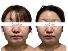 マヌレニ(manuleni)/別人級変化は当院フルコースで◎