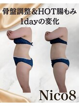 ニコエイト(Nico8)/◇骨盤調整＆HOT腸もみ◇