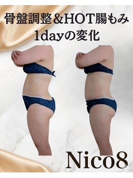 ニコエイト(Nico8)/◇骨盤調整&HOT腸もみ◇
