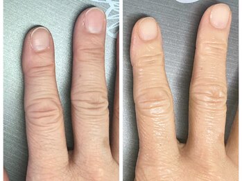 桃の木 吉祥寺店/40代　ハンドケア＆ネイルケア