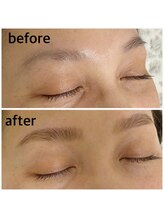 タリプラス(TALI+)/アイブロウ＋WAX脱毛