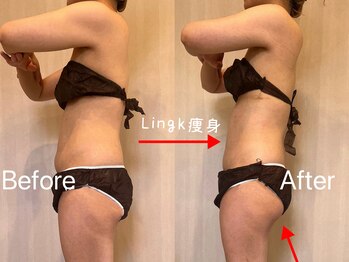 リングケー(Ling K)/LingK痩身