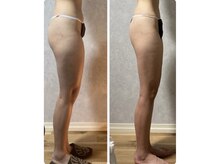 スリーピングビューティー(Sleeping Beauty)/インディバ　ヒップアップ