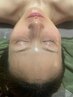 20代30代の方向け★たるみ毛穴特化水光ピール¥15000→¥11000