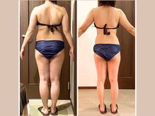 リライブ 亀有店(Re:Lives)/全身ビフォーアフター【痩身】