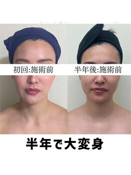 お顔の研究所/ビフォーアフター写真♪
