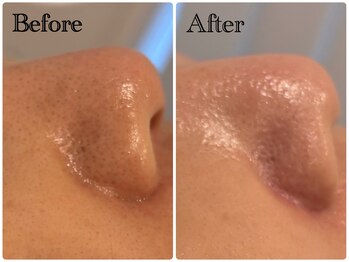 グラサヴォーグ 金沢店/アルティメイトトリートメント★