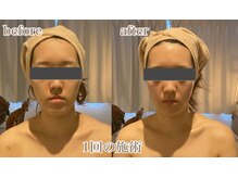 ラ フルール 折尾店/小顔矯正コルギ