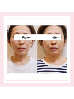 ル フラーズ(Les Fleurs)/50代後半のお客様