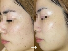 ミーラヤ(MILAYA)/