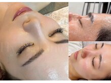 ボヌール(bonheur)の雰囲気（当店イチオシGloss肌トリートメントbefore/after #水まんじゅう）