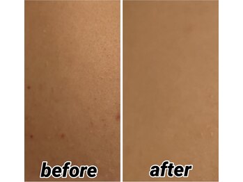 マニッシュ(Mannish)/背中ララピール