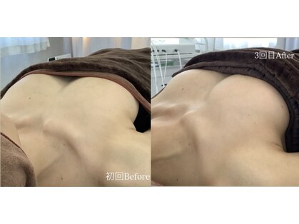 エニバストケア 草津の写真
