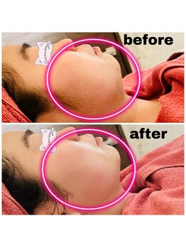 リンク(LiNK)/☆相乗効果で☆