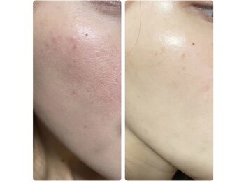 トゥモロー(TOMORROW)/メイクするのが楽しくなる肌へ