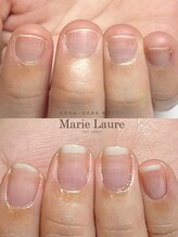 マリーロール 淀屋橋本店(Marie Laure)/自爪育成/深爪矯正/ネイルケア
