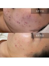 グレイス(Grace)/