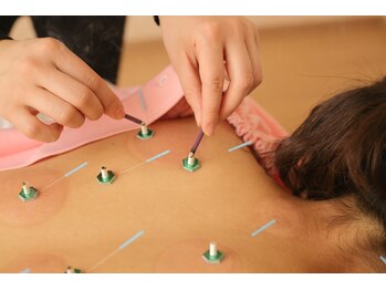 メイロン 恵比寿Mana院(meilong)/全身鍼灸施術!