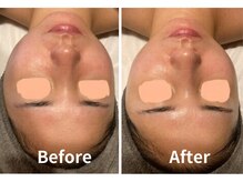 サロン デ ミロ(Salon de Miro)/BeforeAfter多数！ブログへGO♪