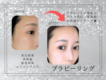 スア(SUA)/プラピール