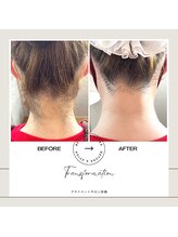 プライベートサロン 安樹/エステ脱毛でもここまでの結果★