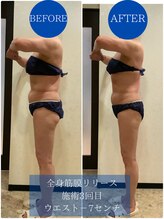 ヴィオテラス(VIOTERACE)/★全身筋膜リリース★