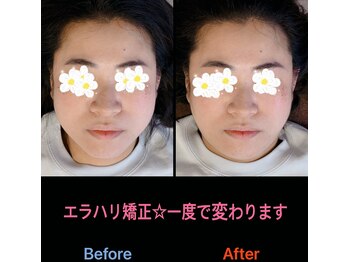 美容矯正サロン レレポノ(LELEPONO)/