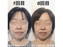 経堂鍼灸整体院