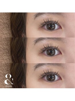 オリ(Oli)/アンドヘルシー 100本