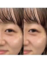 ソリン(Solin')/まつげパーマカールデザイン