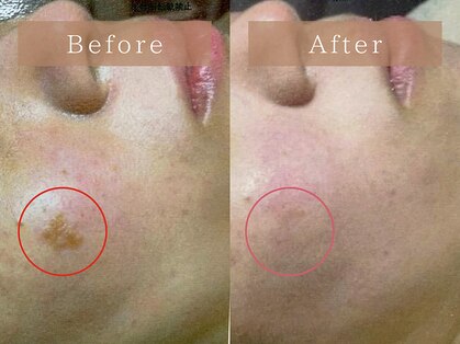 フローラ(FLORA)の写真