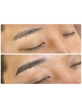 メンズフェイシャル