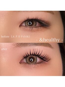 アネラ(anela)/&healthy