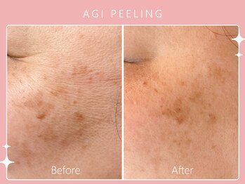 シロカネ イオンタウン西熊本店(SHIROKANE)/アギピーリング☆