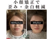 キュープ 浜松店(Qpu)の雰囲気（小顔効果だけなく顔の左右バランスも均等に。顔質が変わります。）